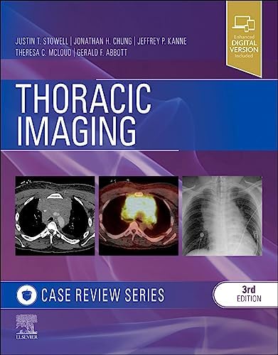 Diagnostic Imaging: Chest: 9780323796637: Medicine & Health